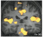 FMRI from the study