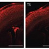 forebrain of a mouse