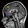 brain neural activity