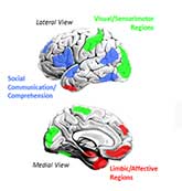 brain regions in autism